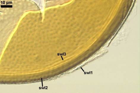 Spore characters / Acaulospora scrobiculata-65-9-MR-r.psd