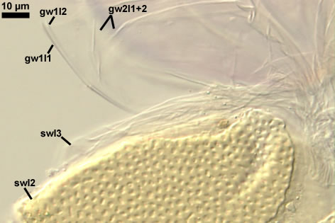 Acaulospora scrobiculata / Acaulospora scrobiculata-78-9-MR-r.psd