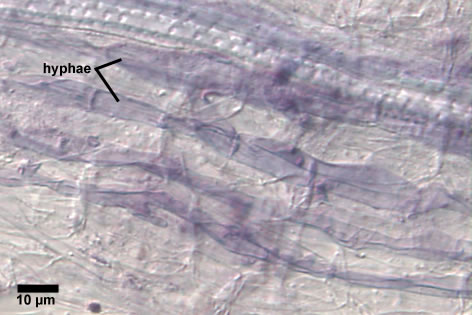 Glomus aggregatum / Glomus aggregatum-67-9-Pl-PV-r.psd